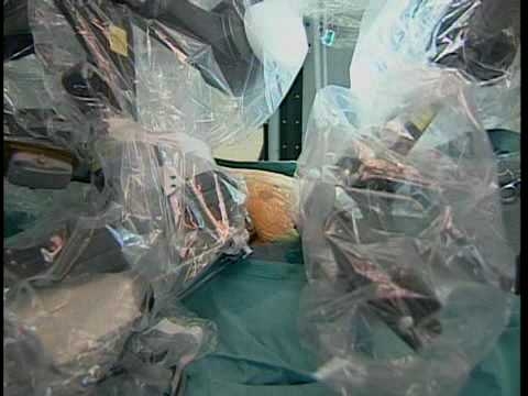 Robotic Surgery In Gynecology
