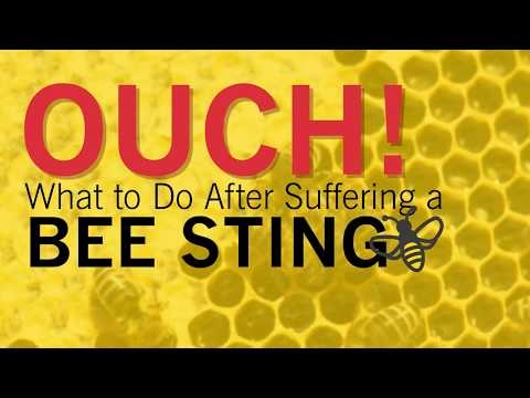 What To Do After A Bee Sting