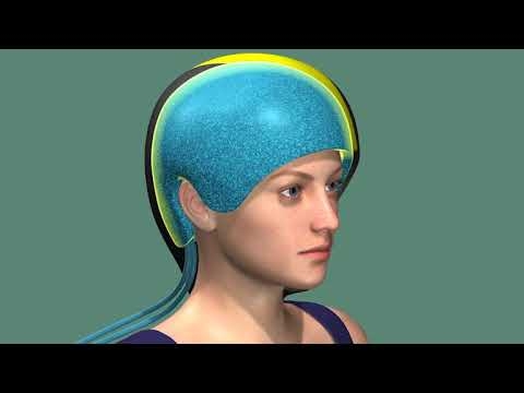 Scalp Cooling For Reducing Chemotherapy Hair Loss