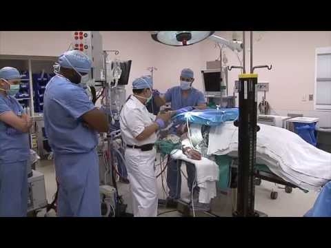 Lung Procedure Cleans Airways For Easy Breathing