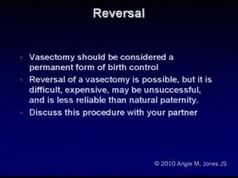 Benefits Of Percutaneous No Scalpel Vasectomy