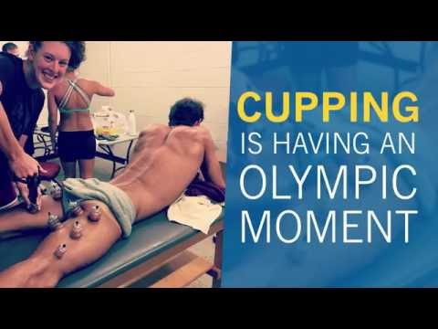 Cupping: Why Olympic Athletes Are Sporting Red Spots