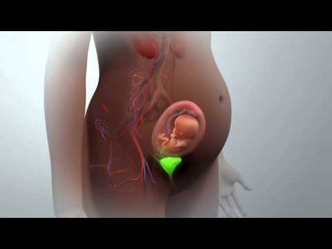 Prenatal Radiation Exposure
