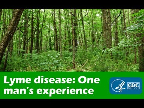One Man's Experience with Lyme Disease