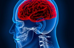 Brain Surgery – Craniotomy