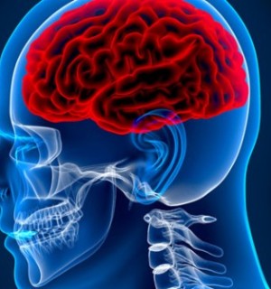 Brain Surgery – Craniotomy