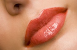 Lip Augmentation with Implants