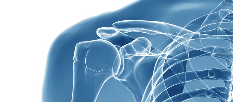 5 Common Types of Shoulder Surgery