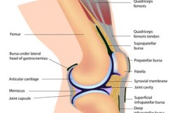 Open Proximal Realignment of the Patella