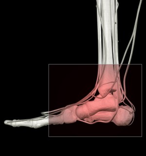 Ankle Arthrocentesis