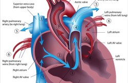 Aortic Valve Replacement Surgery