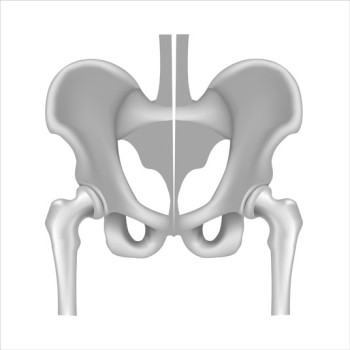 Arthroscopic Hip Synovectomy