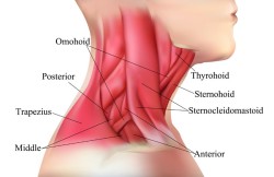 Complete Sternocleidomastoid Resection