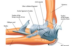 Elbow Synovectomy
