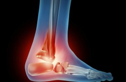 Foot Joint Replacement