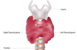 Laparoscopic Partial Thyroidectomy