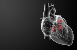 Heart Valve Replacement Surgery
